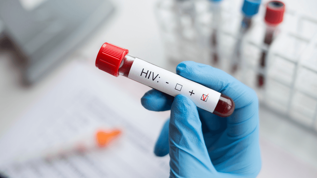 HIV/AIDS Symptoms