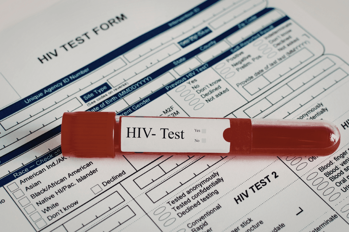 Non Reactive HIV Test