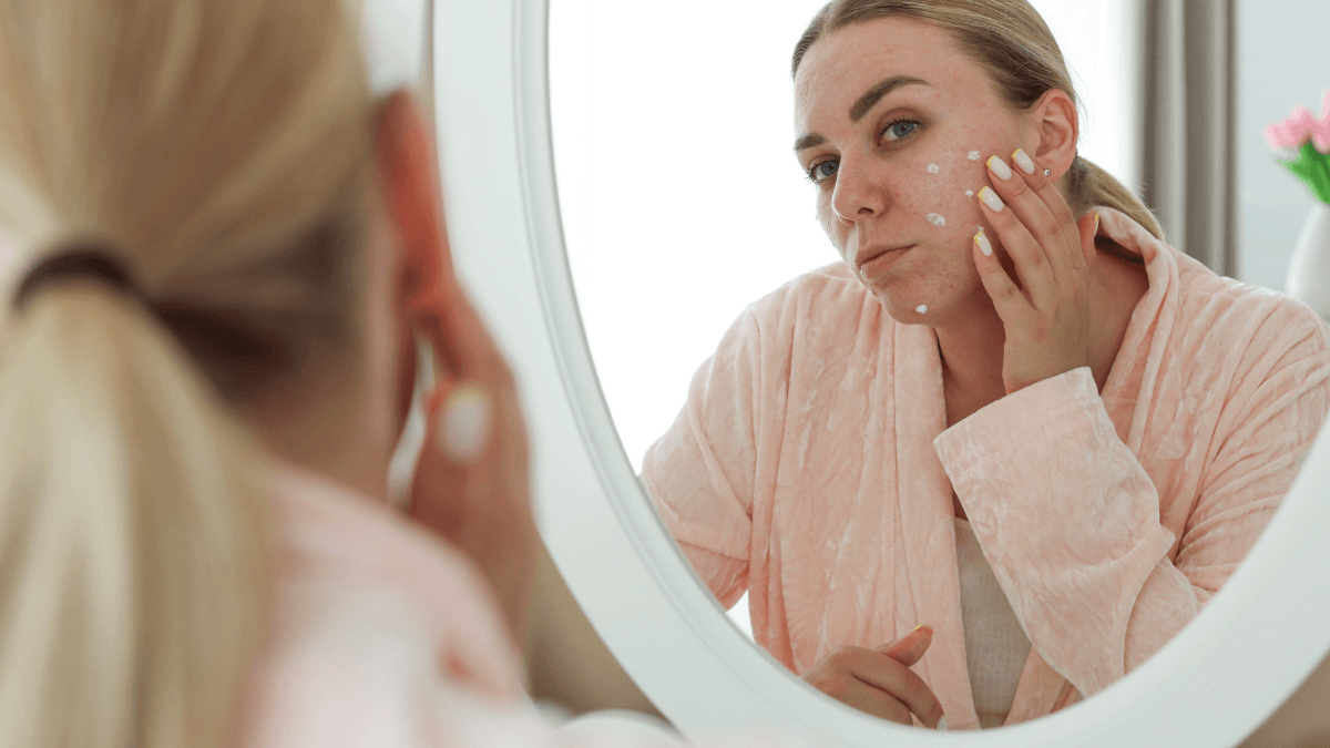 What Helps With Acne Scars