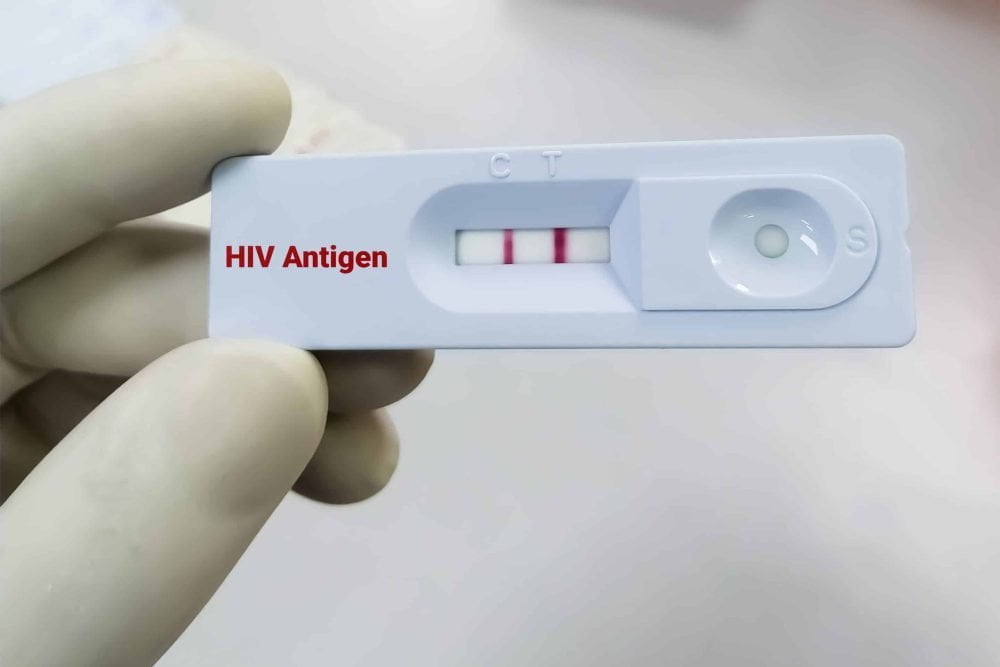 Types Of HIV Tests Timing And Accuracy Checklist Types Of HIV Tests Timing And Accuracy Checklist