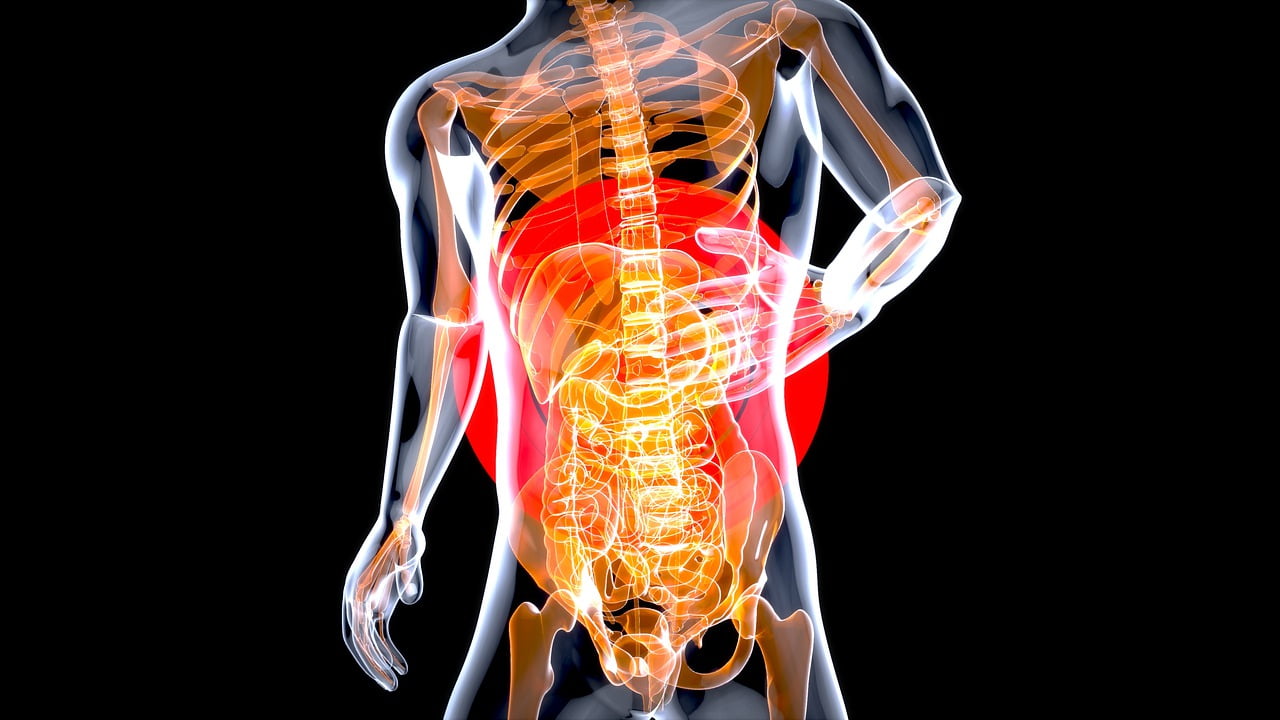 cálculos renales y salud intestinal