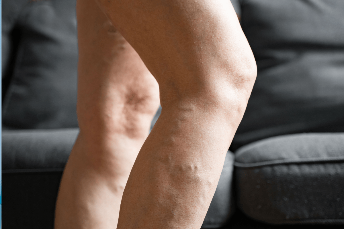 best time to take xarelto 20 mg