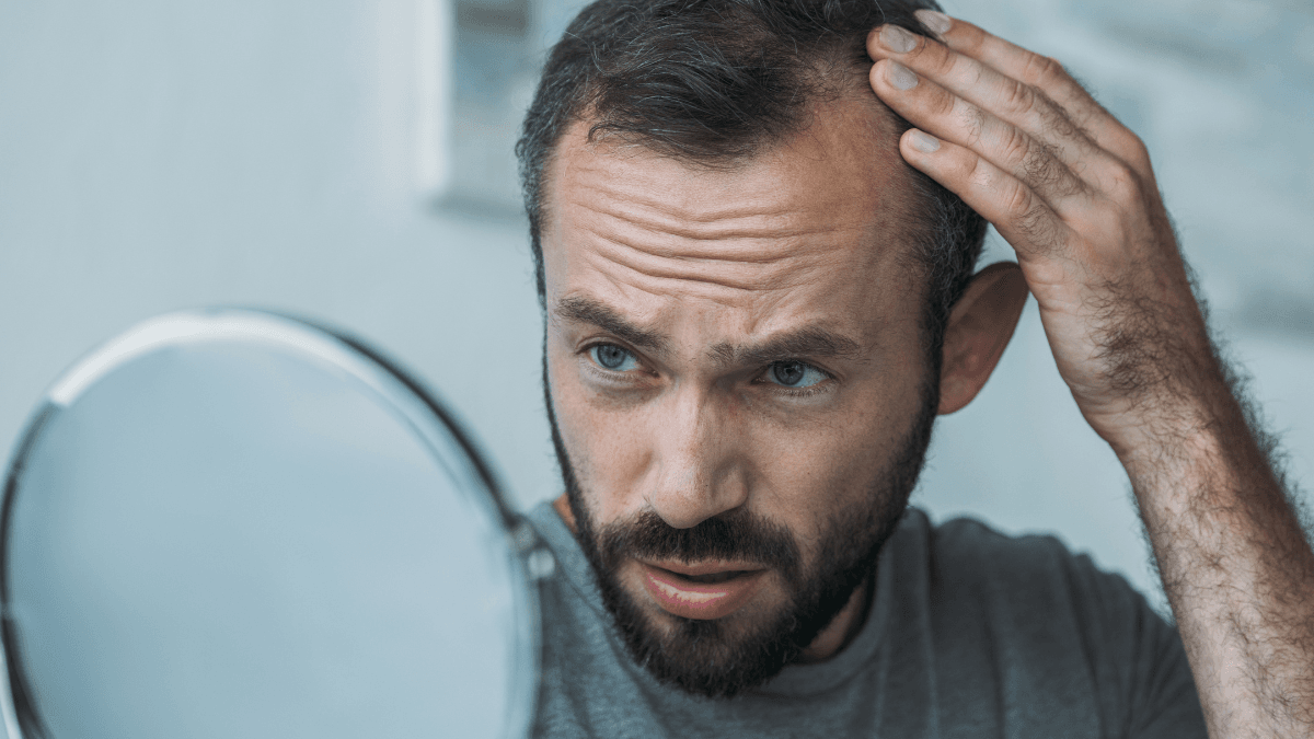 Metformin and Hair Loss: Evidence, CCCA, and Recovery