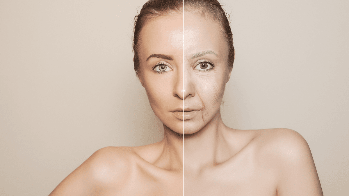 Ozempic Face Before and After