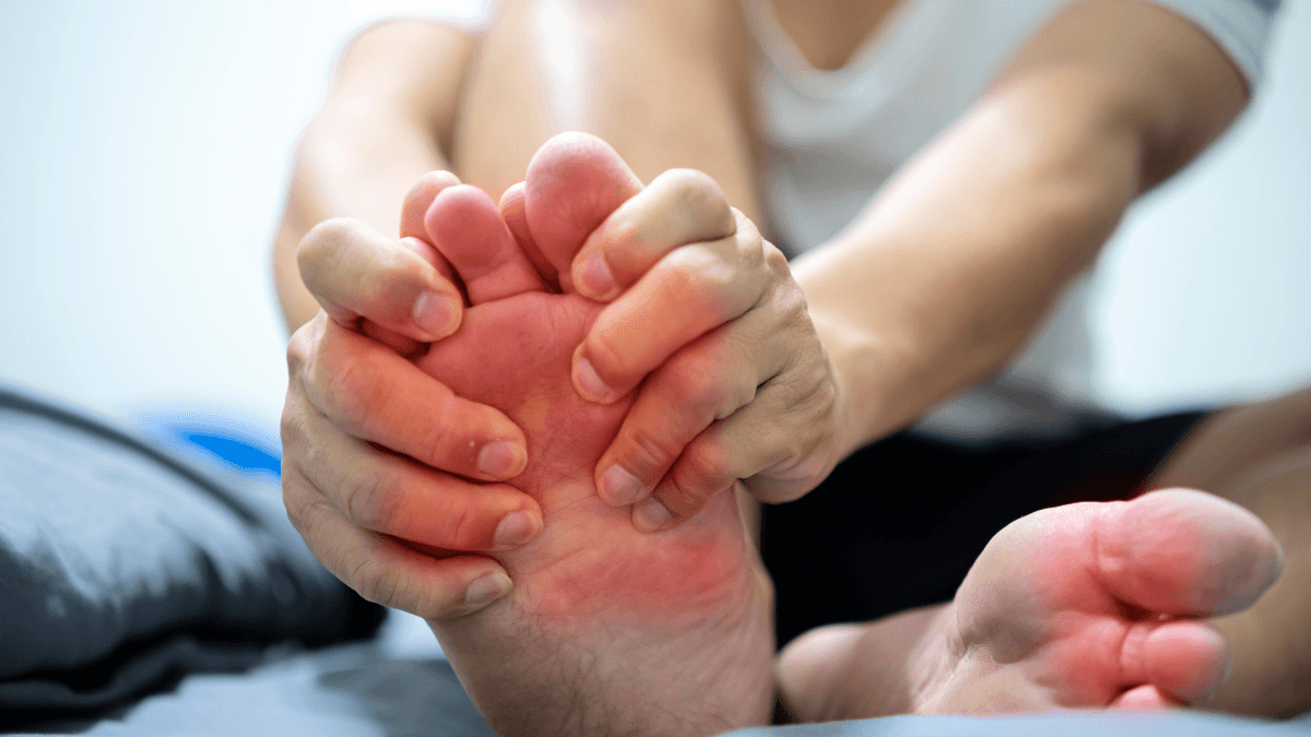 Metformin for Reducing Gout Risk