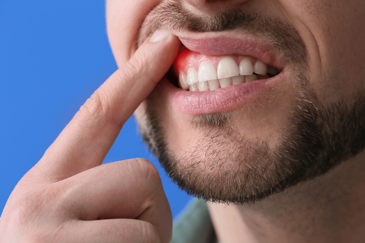 Metformin for Treating Gum Disease