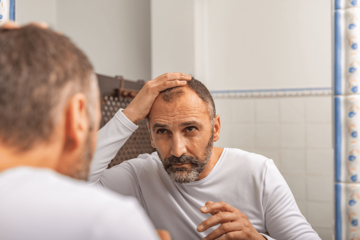 Pioglitazone Reverse Hair Loss