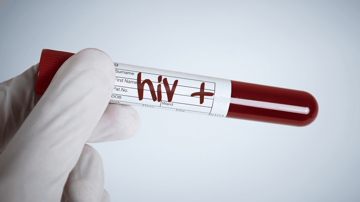 Metformin and HIV