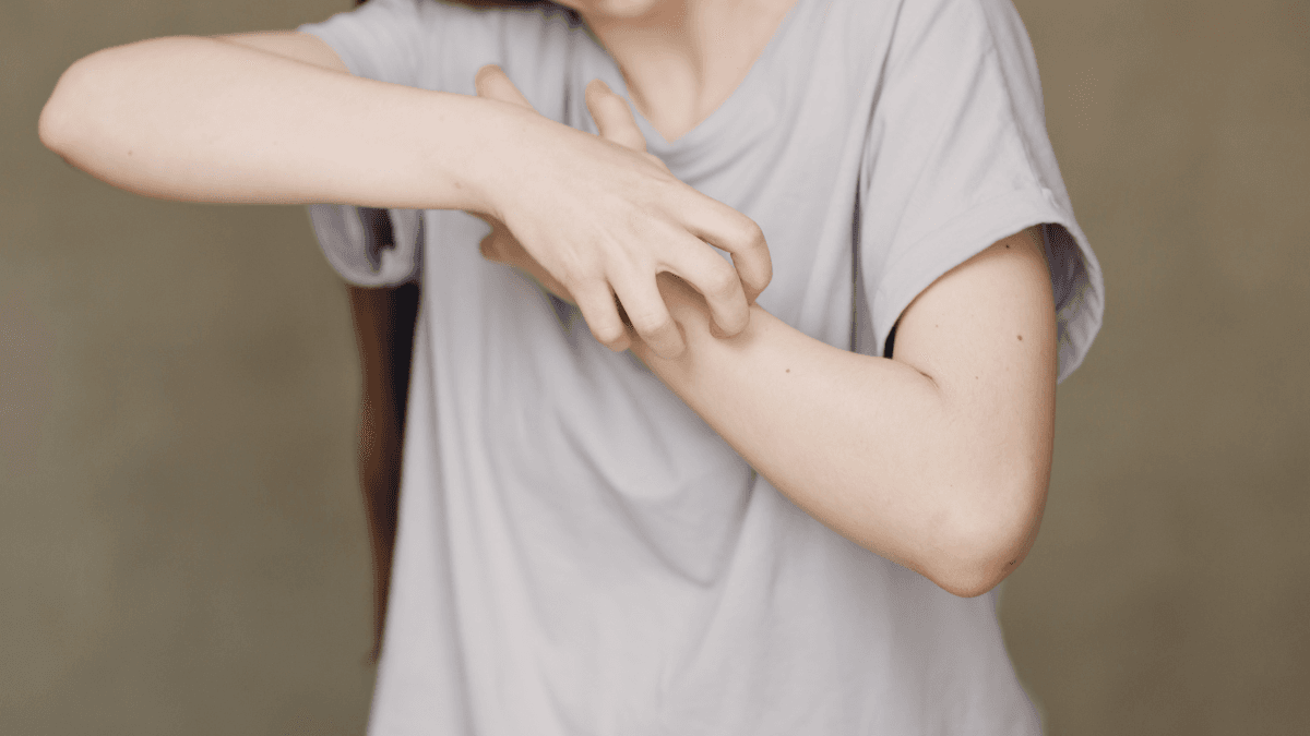 Ajovy Side Effects